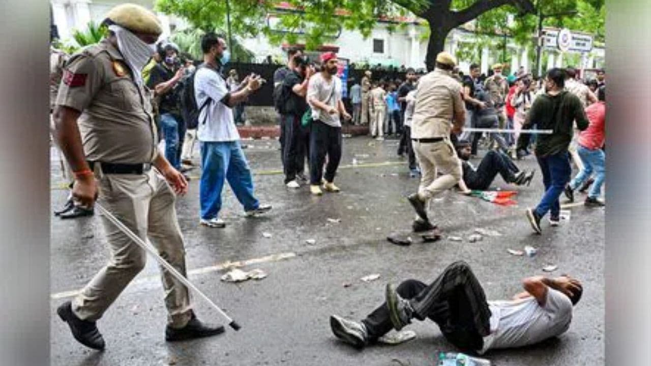 पेलेट गन-शॉक गन से घायल छात्र अस्पताल में, दिल्ली पुलिस के खंडन में कितना दम पेलेट गन-शॉक गन से घायल छात्र अस्पताल में, दिल्ली पुलिस के खंडन में कितना दम
