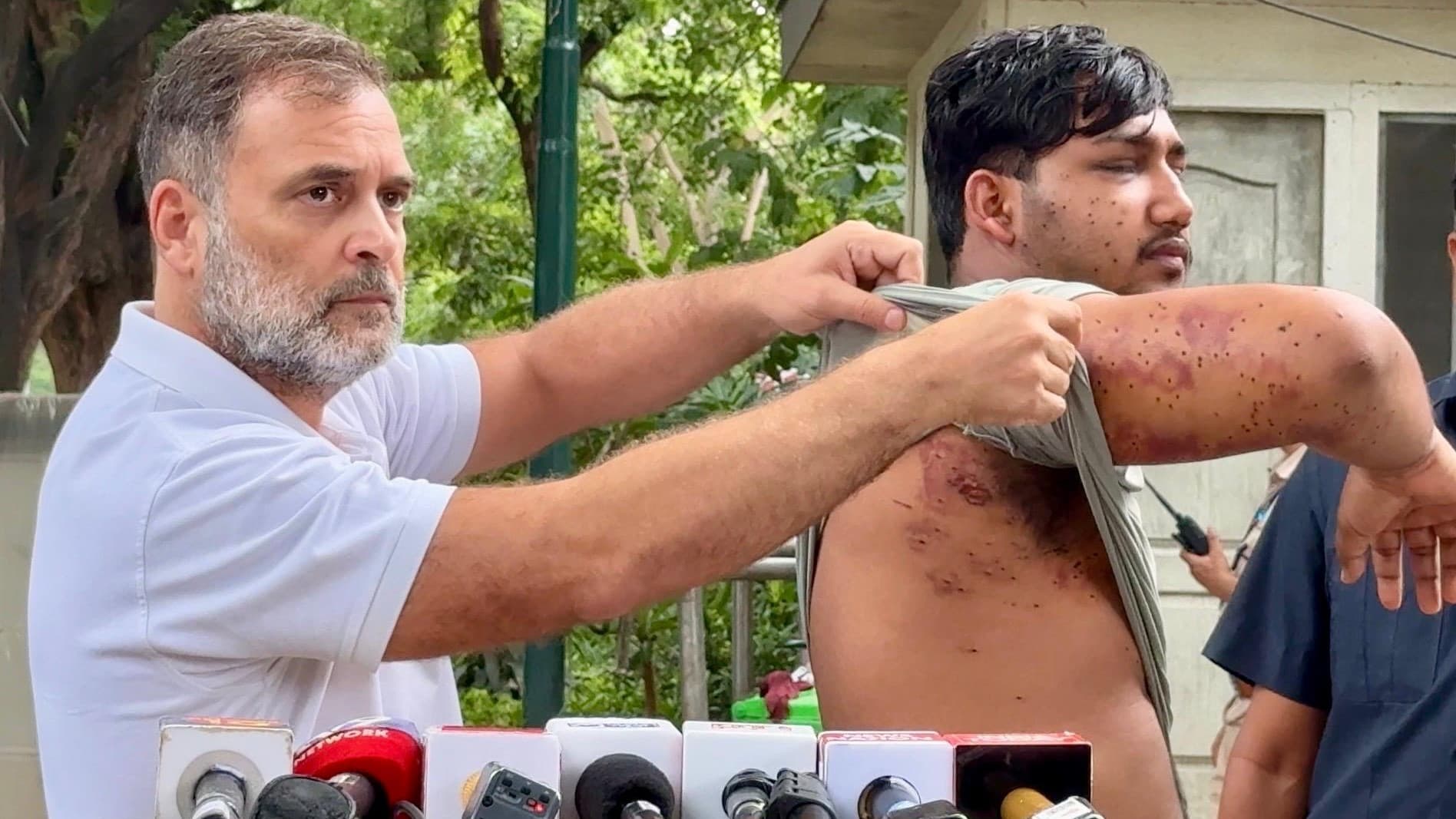 जंतर मंतर प्रोटेस्ट में हजारों युवाओं पर पैलेट गन चलाई गई: राहुल बोले 'साहिल की आंख ख़राब हो गई' जंतर मंतर प्रोटेस्ट में हजारों युवाओं पर पैलेट गन चलाई गई: राहुल बोले 'साहिल की आंख ख़राब हो गई'