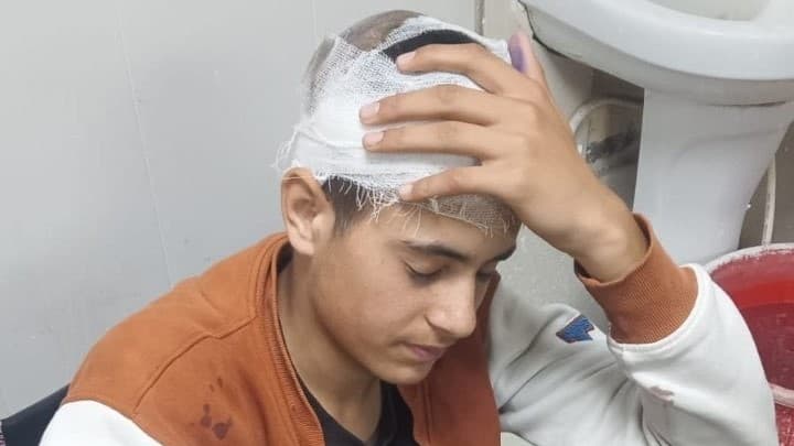 कश्मीरी शॉल बेचने वाले 17 साल के ताबिश पर क्रूर हमला; 'अपने ही लोगों से ऐसी नफ़रत' कश्मीरी शॉल बेचने वाले 17 साल के ताबिश पर क्रूर हमला; 'अपने ही लोगों से ऐसी नफ़रत'